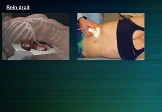 Rein droit
Foie
Rein
 