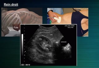 Rein droit
Foie
Rein
 