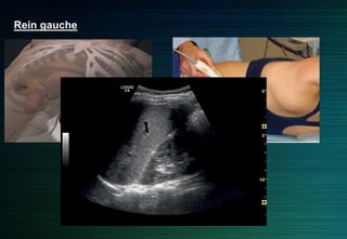 Rein gauche
Rein
 