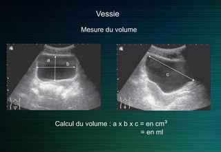 Vessie
Vue Longitudinale
 