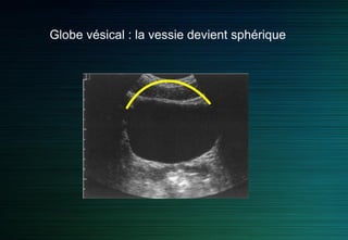 Vessie
Mesure du volume
b
c
Calcul du volume : a x b x c x 0,625 = en cm³
= en ml
a
 