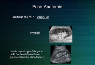 Echo-Anatomie
invisible
Autour du rein : capsule
parfois aspect hyperéchogène
à la frontière hépatorénale
( graisse périrénale abondante++)
 