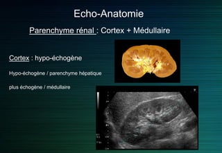 Echo-Anatomie
Parenchyme rénal : Cortex + Médullaire
Cortex : hypo-échogène
Hypo-échogène / parenchyme hépatique
plus échogène / médullaire
 