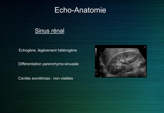 Echo-Anatomie
Sinus rénal
Echogène, légèrement hétérogène
Différentiation parenchymo-sinusale
Cavités excrétrices : non visibles
 