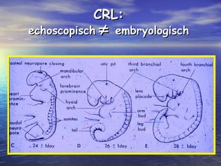 CRL:CRL:
echoscopischechoscopisch ≠≠ embryologischembryologisch
 