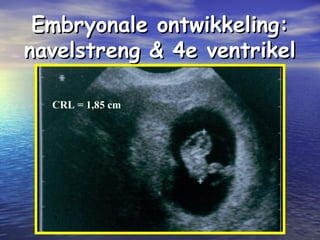 Embryonale ontwikkeling:Embryonale ontwikkeling:
navelstreng & 4e ventrikelnavelstreng & 4e ventrikel
CRL = 1,85 cm
 