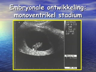 Embryonale ontwikkeling:Embryonale ontwikkeling:
monoventrikel stadiummonoventrikel stadium
 