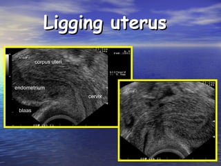 Ligging uterusLigging uterus
 