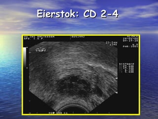 Eierstok: CD 2-4Eierstok: CD 2-4
 