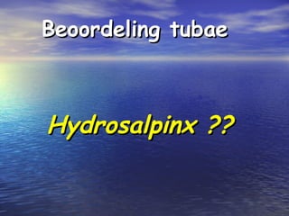 Beoordeling tubaeBeoordeling tubae
Hydrosalpinx ??Hydrosalpinx ??
 