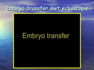 Embryo transfer met echoscopieEmbryo transfer met echoscopie
 