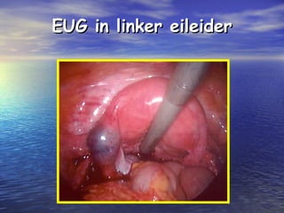 EUG in linker eileiderEUG in linker eileider
 