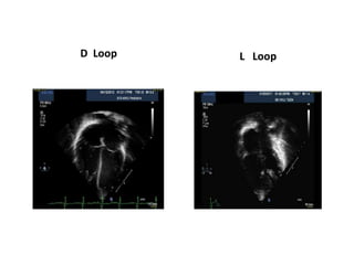 D Loop L Loop
 