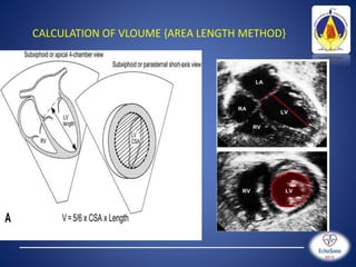 pediatric echo measurements technique z score | PPTX