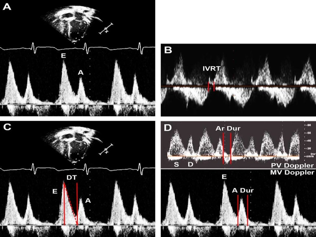 pediatric echo measurements technique z score