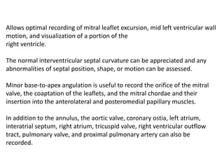 Allows optimal recording of mitral leaflet excursion, mid left ventricular wall
motion, and visualization of a portion of the
right ventricle.
The normal interventricular septal curvature can be appreciated and any
abnormalities of septal position, shape, or motion can be assessed.
Minor base-to-apex angulation is useful to record the orifice of the mitral
valve, the coaptation of the leaflets, and the mitral chordae and their
insertion into the anterolateral and posteromedial papillary muscles.
In addition to the annulus, the aortic valve, coronary ostia, left atrium,
interatrial septum, right atrium, tricuspid valve, right ventricular outflow
tract, pulmonary valve, and proximal pulmonary artery can also be
recorded.
 