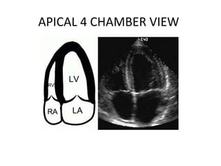 APICAL 4 CHAMBER VIEW
 
