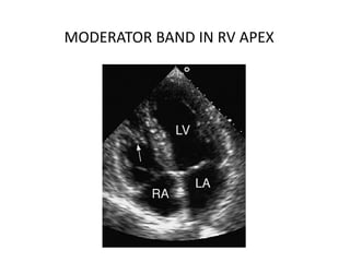 MODERATOR BAND IN RV APEX
 