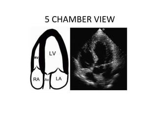 5 CHAMBER VIEW
 