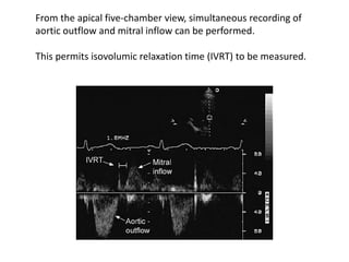 From the apical five-chamber view, simultaneous recording of
aortic outflow and mitral inflow can be performed.
This permits isovolumic relaxation time (IVRT) to be measured.
 