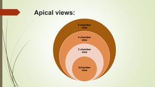 Apical views:
5 chamber
view
4 chamber
view
3 chamber
view
2chamber
view
 