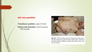 A4C view aquisition:
Transducer position: apex of heart
Marker dot direction: points towards
left shoulder
 
