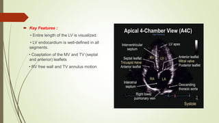 Key Features :
• Entire length of the LV is visualized.
• LV endocardium is well-defined in all
segments.
• Coaptation of the MV and TV (septal
and anterior) leaflets
• RV free wall and TV annulus motion
 