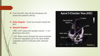  From the A4C view, tilt the transducer tail
toward the patient’s left hip.
 Color Doppler : Color box should include the
AoV.
 Spectral Doppler :
• PW: LVOT (place the sample volume ∼1 cm
proximal to the AoV).
• CW: Place cursor through the vena contracta
of the AoV regurgitant jet or the valve leaflet
coaptation point to evaluate aortic stenosis
(AS).
 