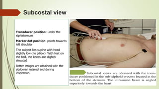 Subcostal view
Transducer position: under the
xiphisternum
Marker dot position: points towards
left shoulder
The subject lies supine with head
slightly low (no pillow). With feet on
the bed, the knees are slightly
elevated
Better images are obtained with the
abdomen relaxed and during
inspiration
 