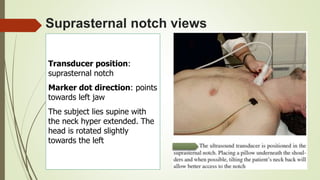 Suprasternal notch views
Transducer position:
suprasternal notch
Marker dot direction: points
towards left jaw
The subject lies supine with
the neck hyper extended. The
head is rotated slightly
towards the left
 