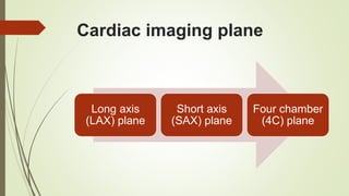 Cardiac imaging plane
Long axis
(LAX) plane
Short axis
(SAX) plane
Four chamber
(4C) plane
 
