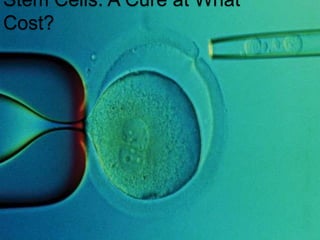 Stem Cells: A Cure at What
Cost?
 