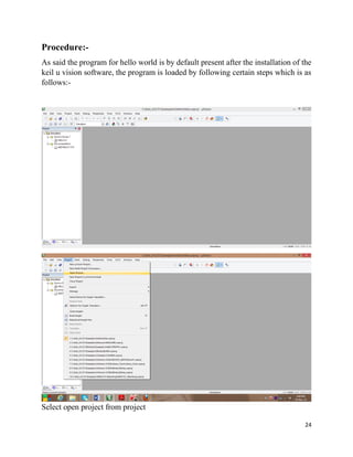 24
Procedure:-
As said the program for hello world is by default present after the installation of the
keil u vision software, the program is loaded by following certain steps which is as
follows:-
Select open project from project
 