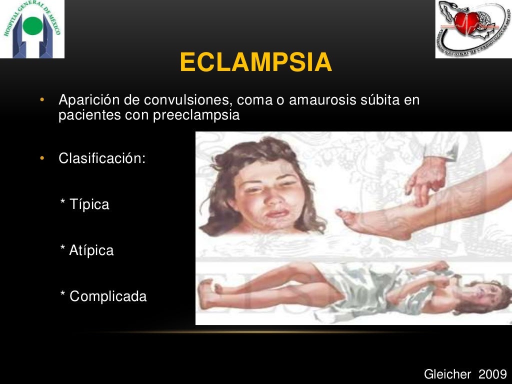 Eclampsia
