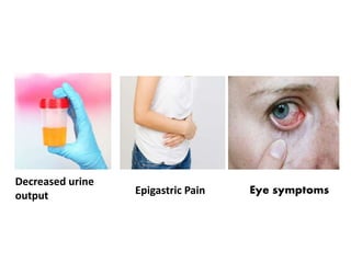 Eye symptomsEpigastric Pain
Decreased urine
output
 