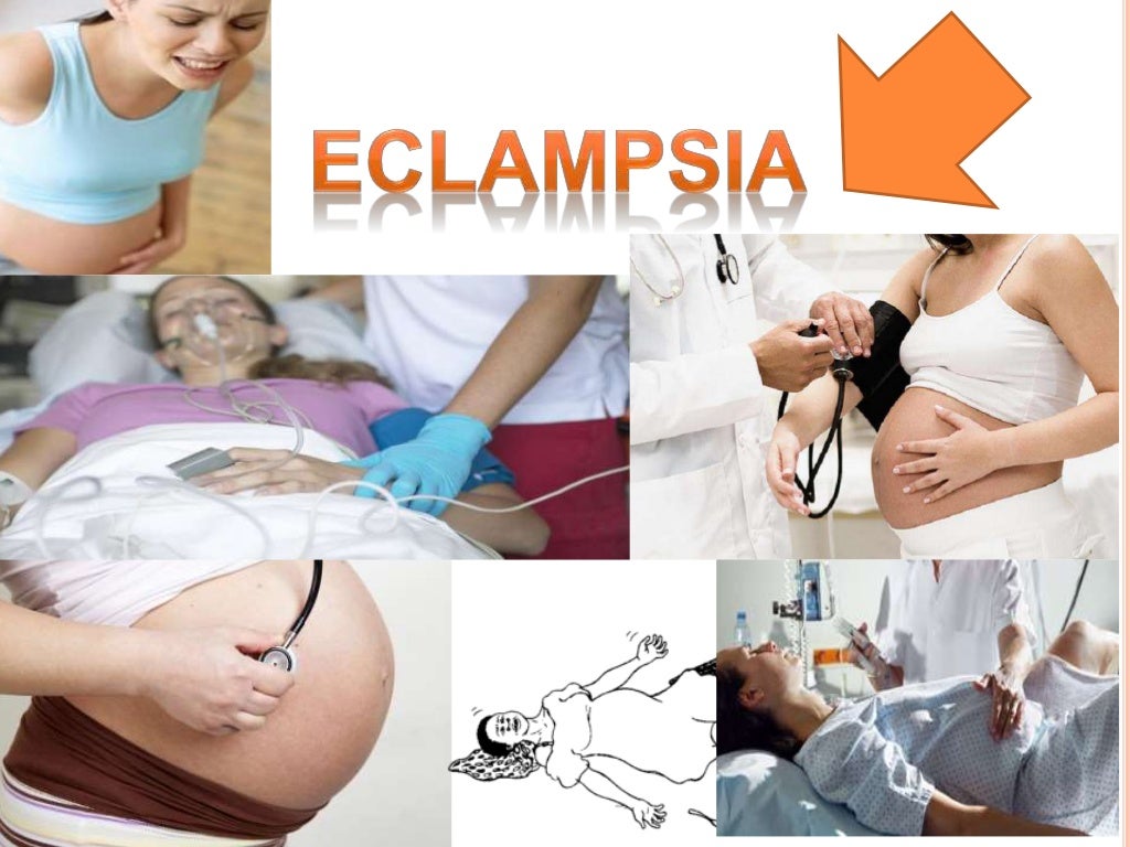 Eclampsia Preeclampsia