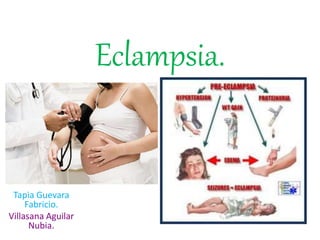 Eclampsia.
Tapia Guevara
Fabricio.
Villasana Aguilar
Nubia.
 