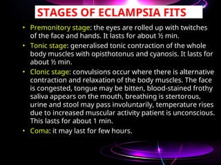 Frothy Stage ECLAMPSIA Cont Nursing Edu OCTOBER 2012.ppt