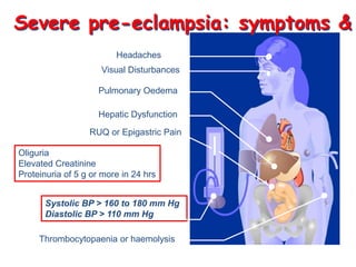 Severe pre-eclampsia: symptoms &
                         Headaches
                     Visual Disturbances

                    Pulmonary Oedema

                    Hepatic Dysfunction

                  RUQ or Epigastric Pain

Oliguria
Elevated Creatinine
Proteinuria of 5 g or more in 24 hrs


       Systolic BP > 160 to 180 mm Hg
       Diastolic BP > 110 mm Hg

     Thrombocytopaenia or haemolysis
 
