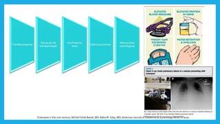 Eclampsia in the 21st century, Michal Fishel Bartal, MD; Baha M. Sibai, MD,American Journal of Obstetrics & Gynecology MONTH 2020
 