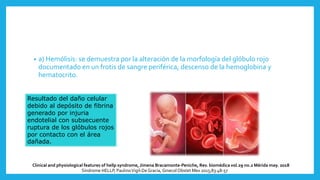 • a) Hemólisis: se demuestra por la alteración de la morfología del glóbulo rojo
documentado en un frotis de sangre periférica, descenso de la hemoglobina y
hematocrito.
Síndrome HELLP, PaulinoVigil-DeGracia, Ginecol Obstet Mex 2015;83:48-57
Resultado del daño celular
debido al depósito de fibrina
generado por injuria
endotelial con subsecuente
ruptura de los glóbulos rojos
por contacto con el área
dañada.
Clinical and physiological features of hellp syndrome, Jimena Bracamonte-Peniche, Rev. biomédica vol.29 no.2 Mérida may. 2018
 