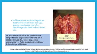 • b) Elevación de enzimas hepáticas:
aspartato transaminasa ≥ 70 U/L,
alanina transferasa ≥ 50 U/L y
deshidrogenasa láctica sérica ≥ 600
U/L.
Síndrome HELLP, PaulinoVigil-DeGracia, Ginecol Obstet Mex 2015;83:48-57
Se encuentra necrosis del parénquima
periportal con depósitos de fibrina en el
espacio sinusoidal. Estos depósitos
obstaculizan el flujo sanguíneo hepático,
distendiendo el hígado.
Clinical and physiological features of hellp syndrome, Jimena Bracamonte-Peniche, Rev. biomédica vol.29 no.2 Mérida may. 2018
 