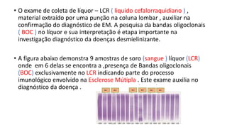• O exame de coleta de líquor – LCR ( liquido cefalorraquidiano ) ,
material extraído por uma punção na coluna lombar , auxiliar na
confirmação do diagnóstico de EM. A pesquisa da bandas oligoclonais
( BOC ) no líquor e sua interpretação é etapa importante na
investigação diagnóstico da doenças desmielinizante.
• A figura abaixo demonstra 9 amostras de soro (sangue ) líquor (LCR)
onde em 6 delas se encontra a ,presença de Bandas oligoclonais
(BOC) exclusivamente no LCR indicando parte do processo
imunológico envolvido na Esclerose Mútipla . Este exame auxilia no
diagnóstico da doença .
 