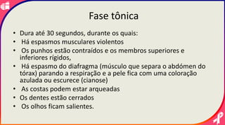 Fase tônica
• Dura até 30 segundos, durante os quais:
• Há espasmos musculares violentos
• Os punhos estão contraídos e os membros superiores e
inferiores rígidos,
• Há espasmo do diafragma (músculo que separa o abdómen do
tórax) parando a respiração e a pele fica com uma coloração
azulada ou escurece (cianose)
• As costas podem estar arqueadas
• Os dentes estão cerrados
• Os olhos ficam salientes.
 