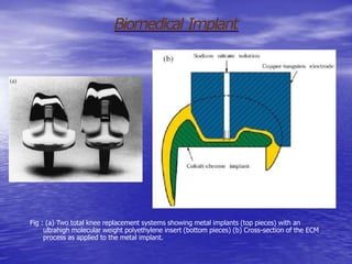 Biomedical Implant
Fig : (a) Two total knee replacement systems showing metal implants (top pieces) with an
ultrahigh molecular weight polyethylene insert (bottom pieces) (b) Cross-section of the ECM
process as applied to the metal implant.
 