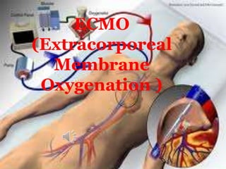 ECMO 
(Extracorporeal 
Membrane 
Oxygenation ) 
 
