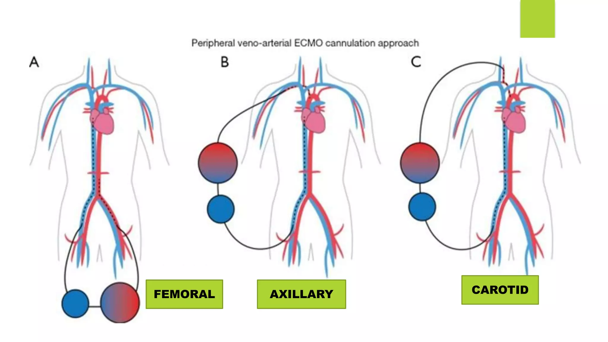 FEMORAL AXILLARY CAROTID
 