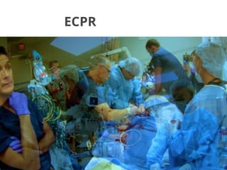 ECPR
 