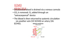 Comprehensive Overview of Extracorporeal Membrane Oxygenation (ECMO ...