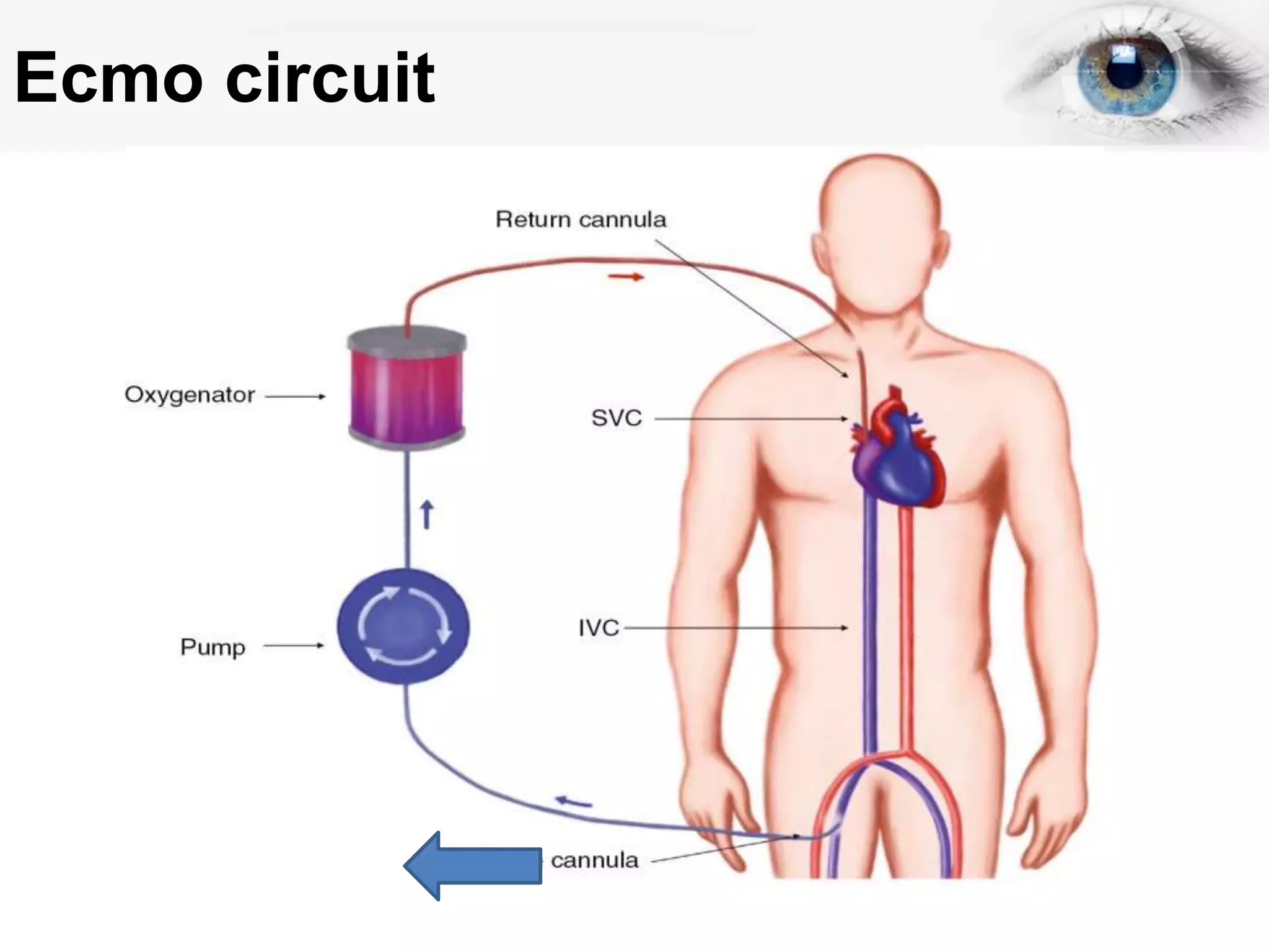 Ecmo dr himaaldev | PPTX